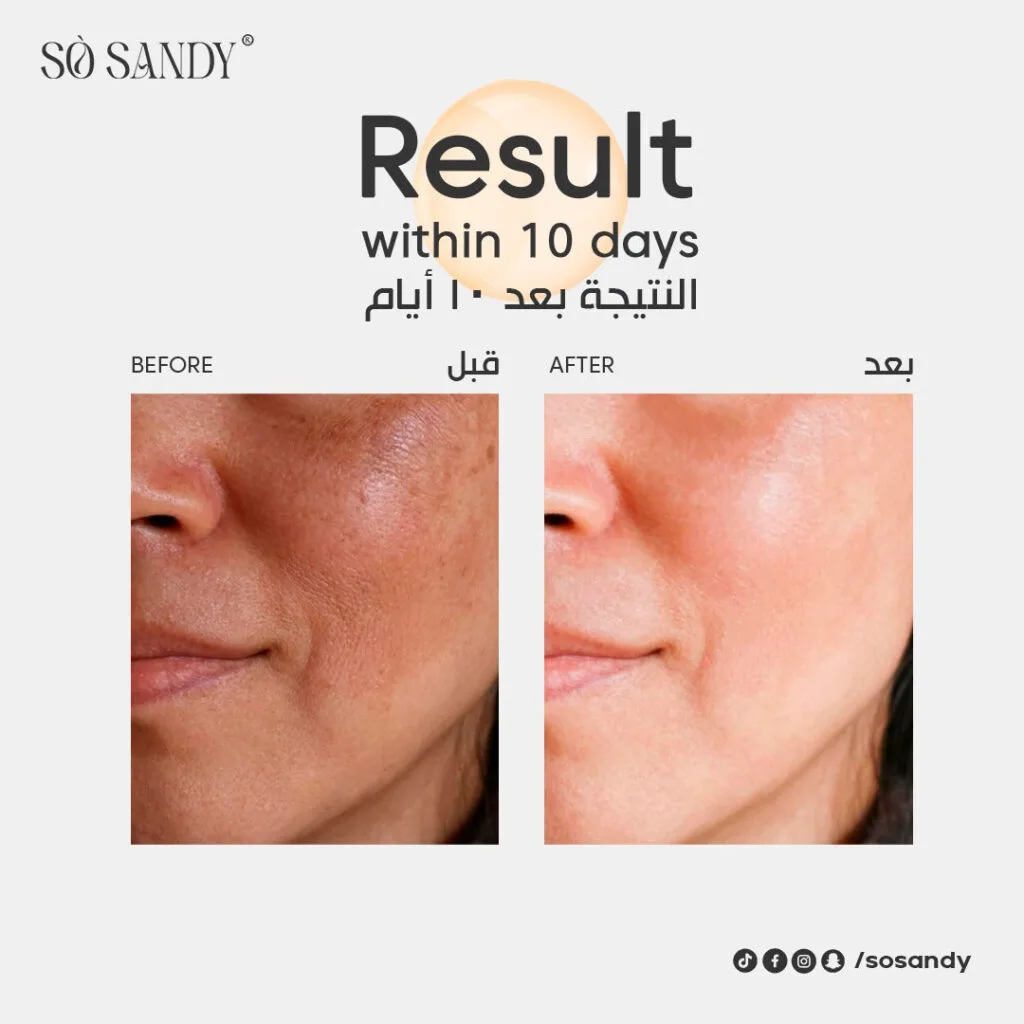 سيروم شاين اند وايت للوجه 30 مل