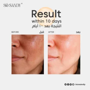 ⁦سيروم شاين اند وايت للوجه 30 مل⁩ - الصورة ⁦3⁩